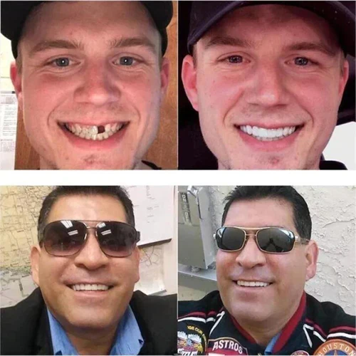 Two before-and-after photos of men who received dental improvements.