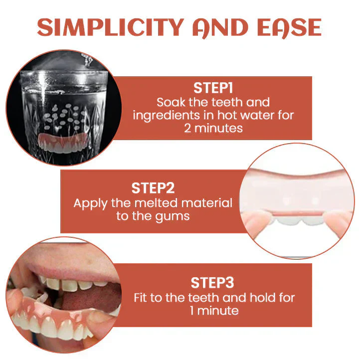 Instructions for fitting dental veneers in three steps.