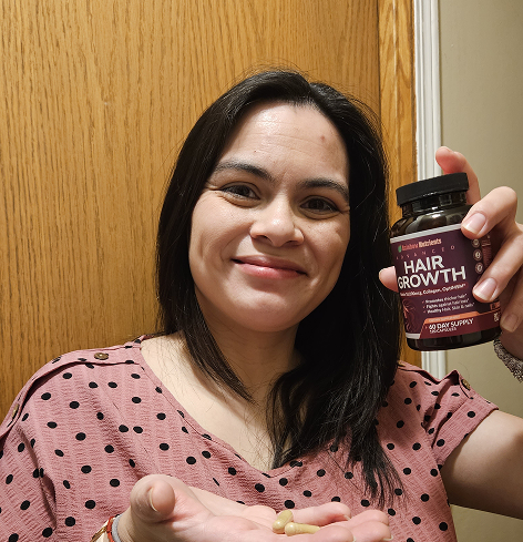 Person holding a bottle of hair growth supplements and pills in hand.
