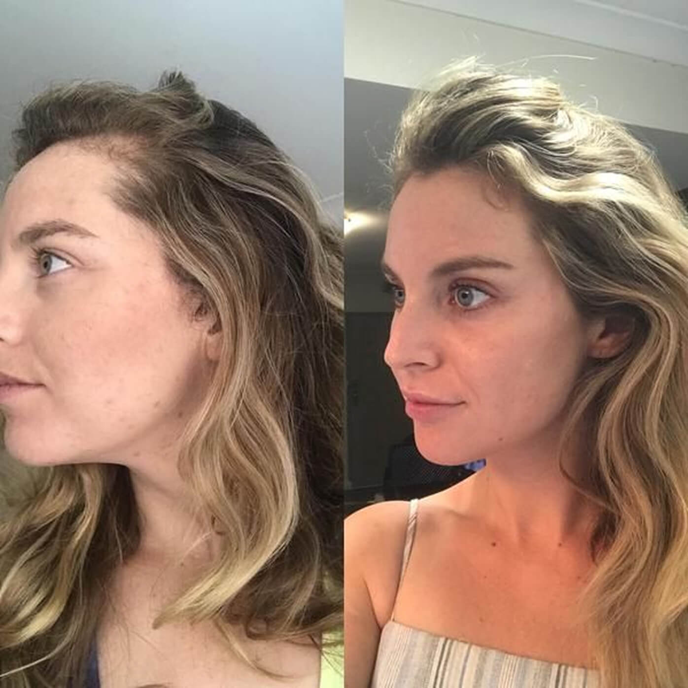 Side-by-side comparison of a woman's profile before and after a change.