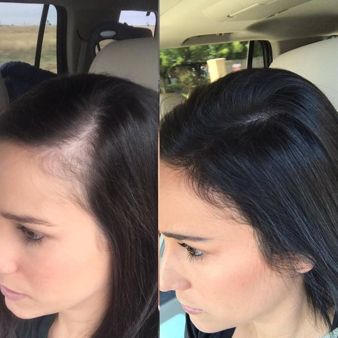 Side-by-side comparison of a woman's hair before and after treatment.