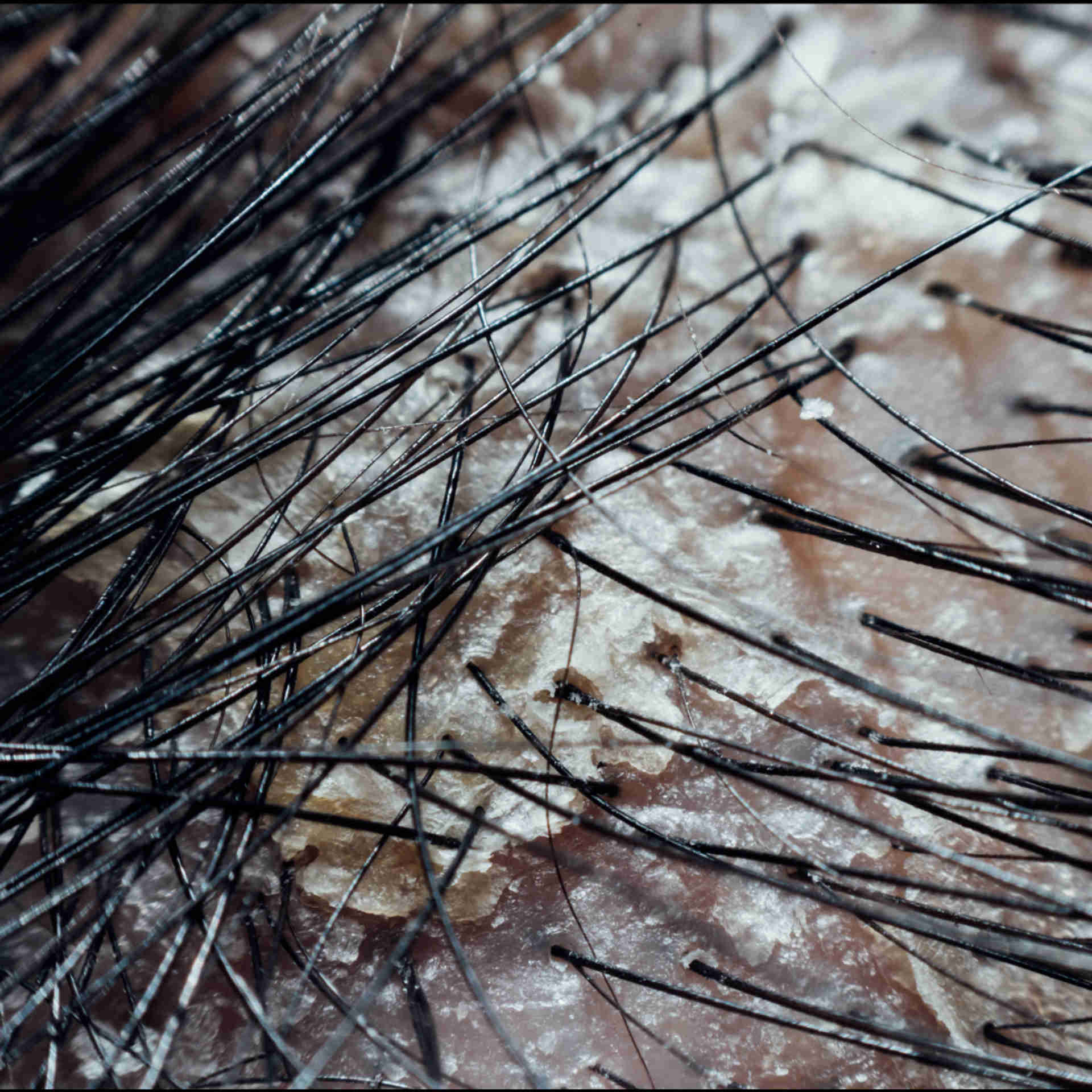 Close-up of hair strands on a textured surface.