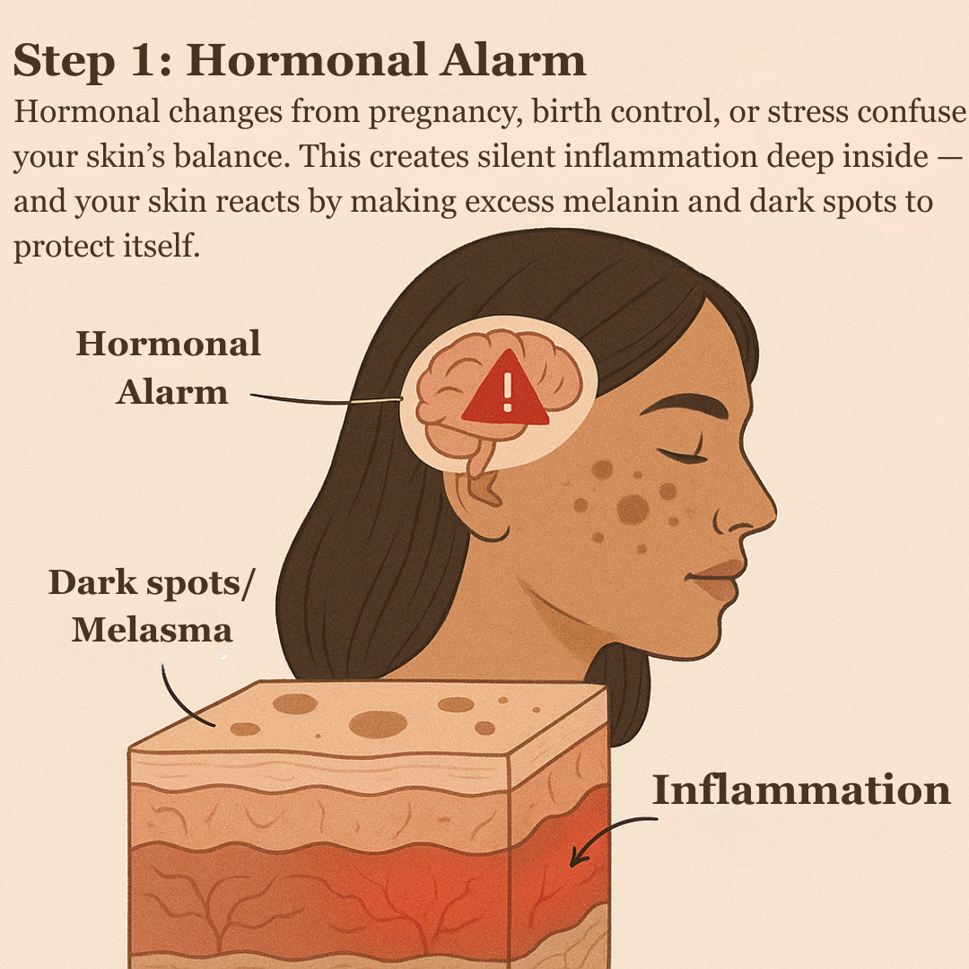 Illustration of hormonal changes causing skin inflammation and dark spots on a woman's face.