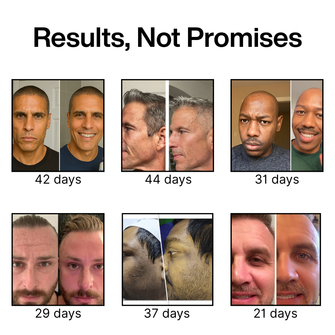 Collage of before-and-after photos showing facial transformations over several days.