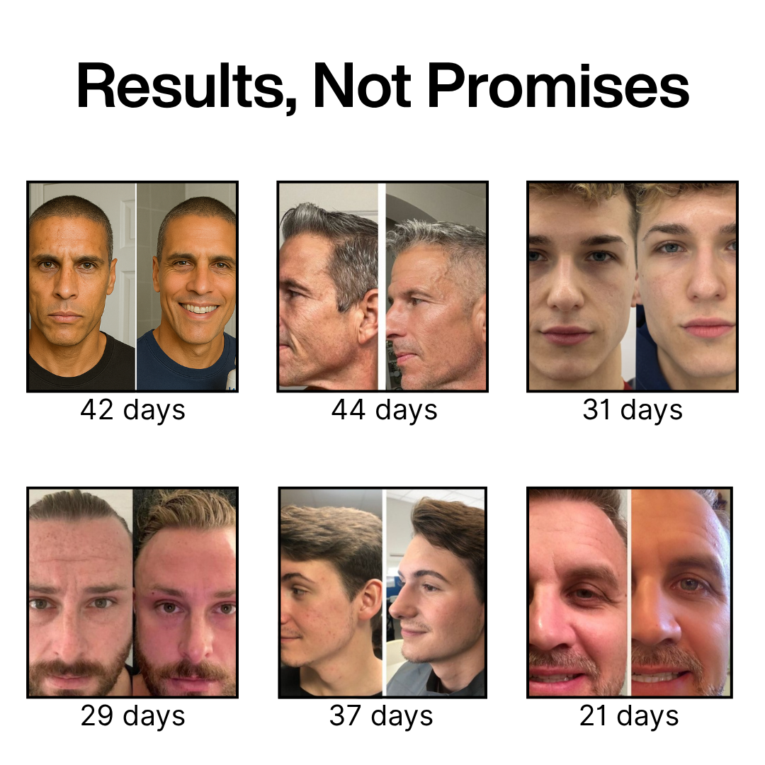 Collage of six before-and-after male facial images with day counts.