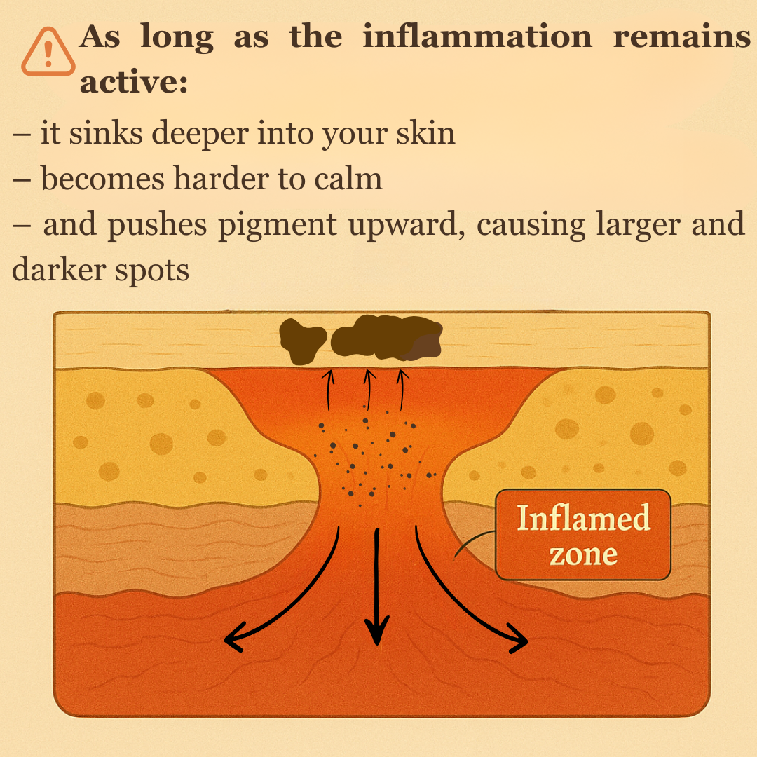 Diagram showing skin inflammation process with text explaining effects on pigmentation.