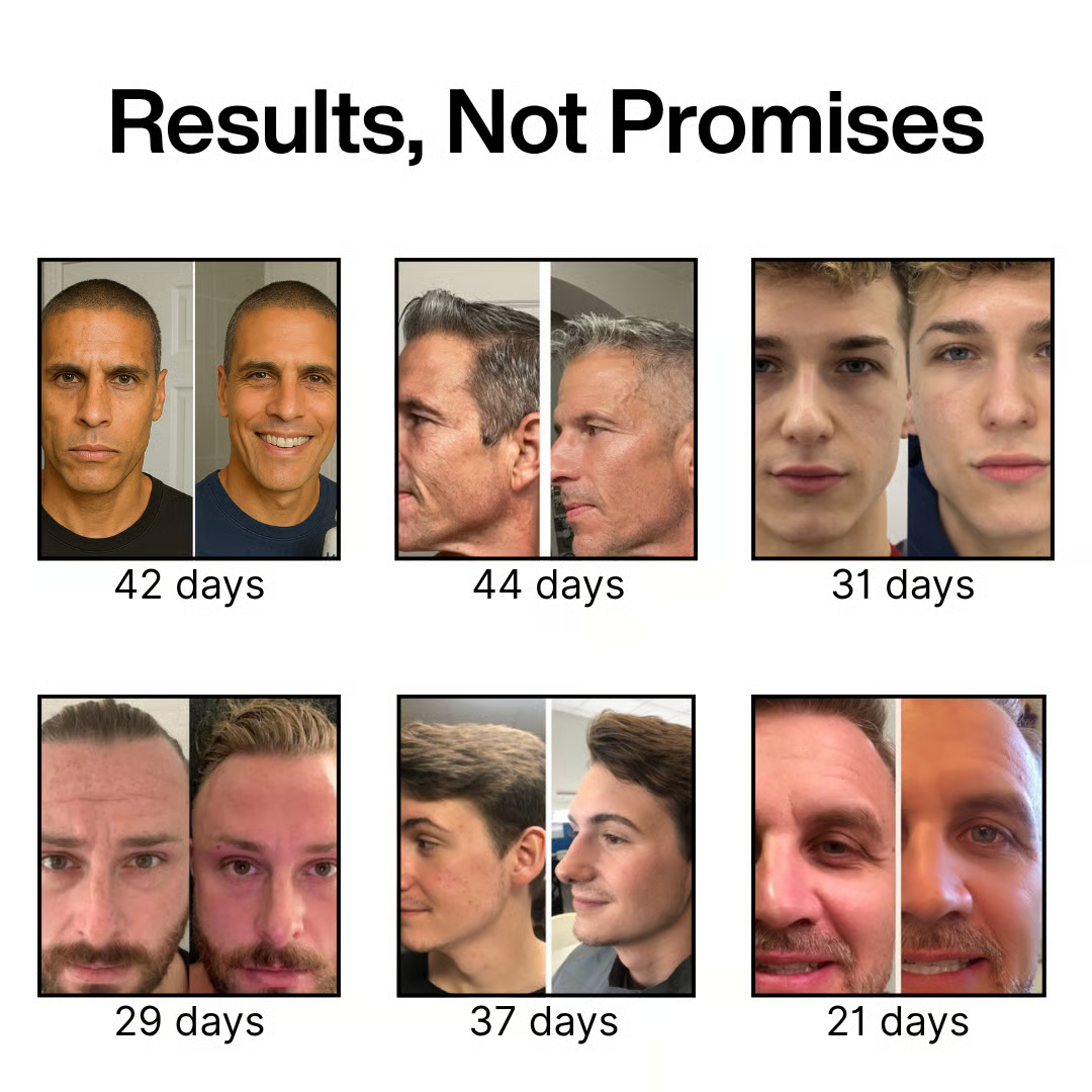 Before and after comparison photos of men's faces with days specified for each change.