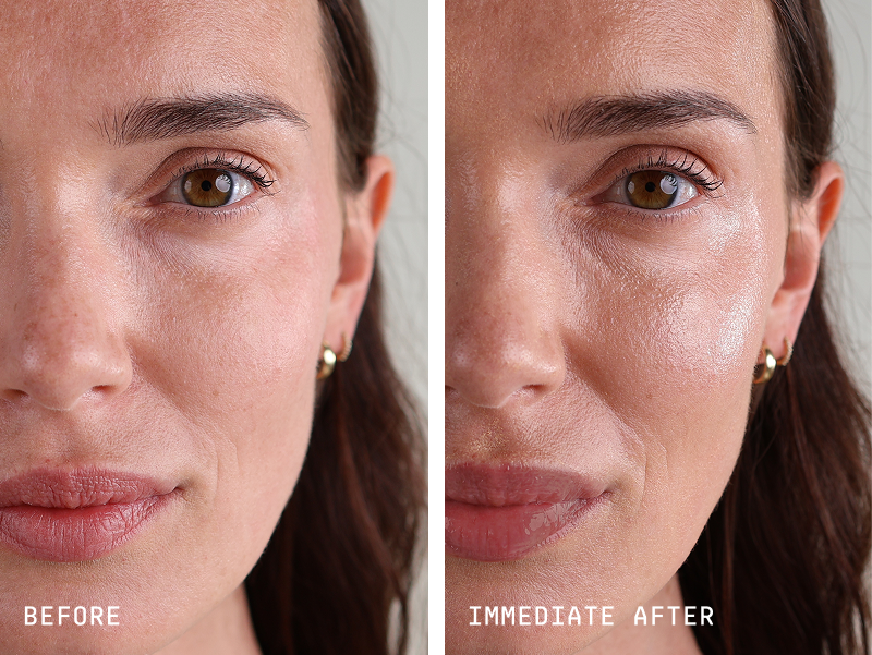 A before-and-after image of a woman's face, showing her skin looking more hydrated and dewy.