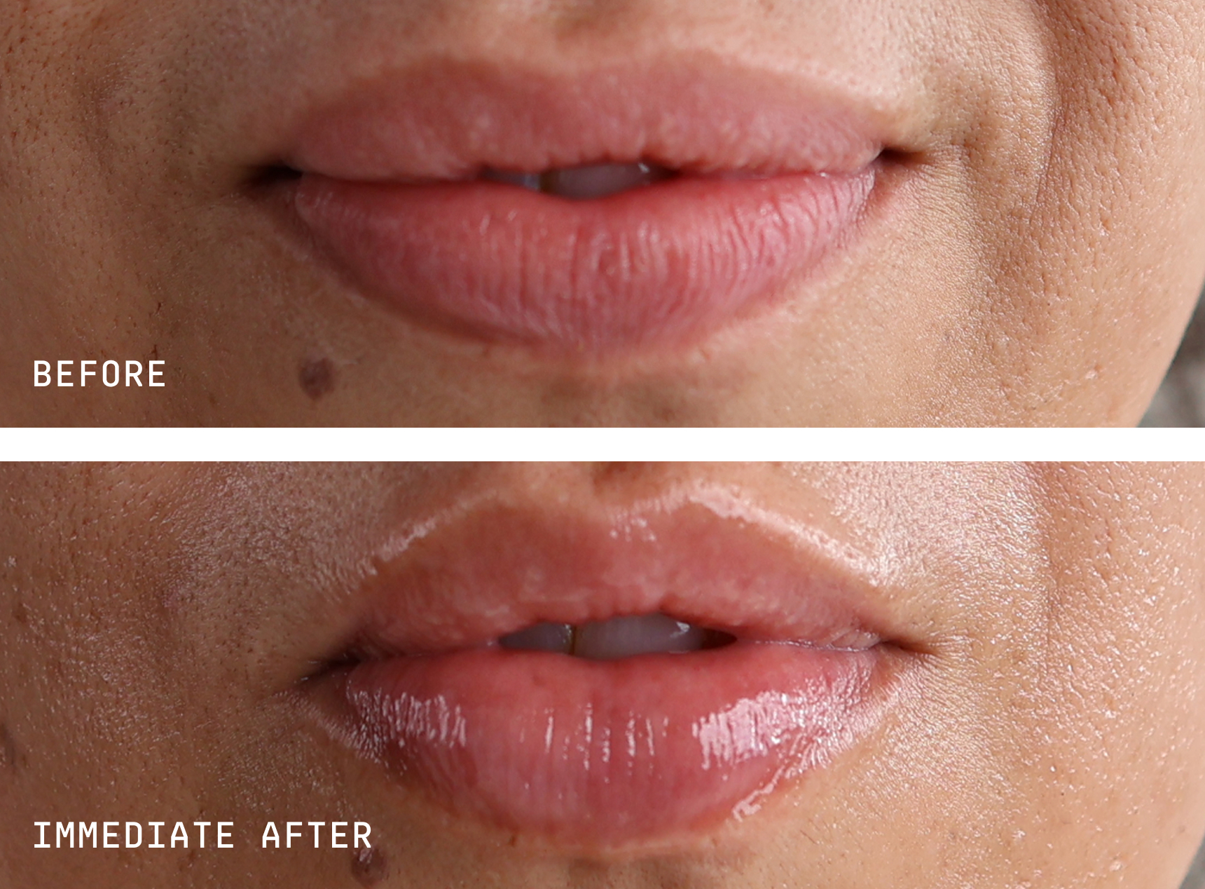 A before-and-after close-up of a person's lips, which appear glossier and plumper in the after image.
