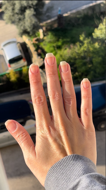 A hand with long nails held up against a background of cars and greenery.