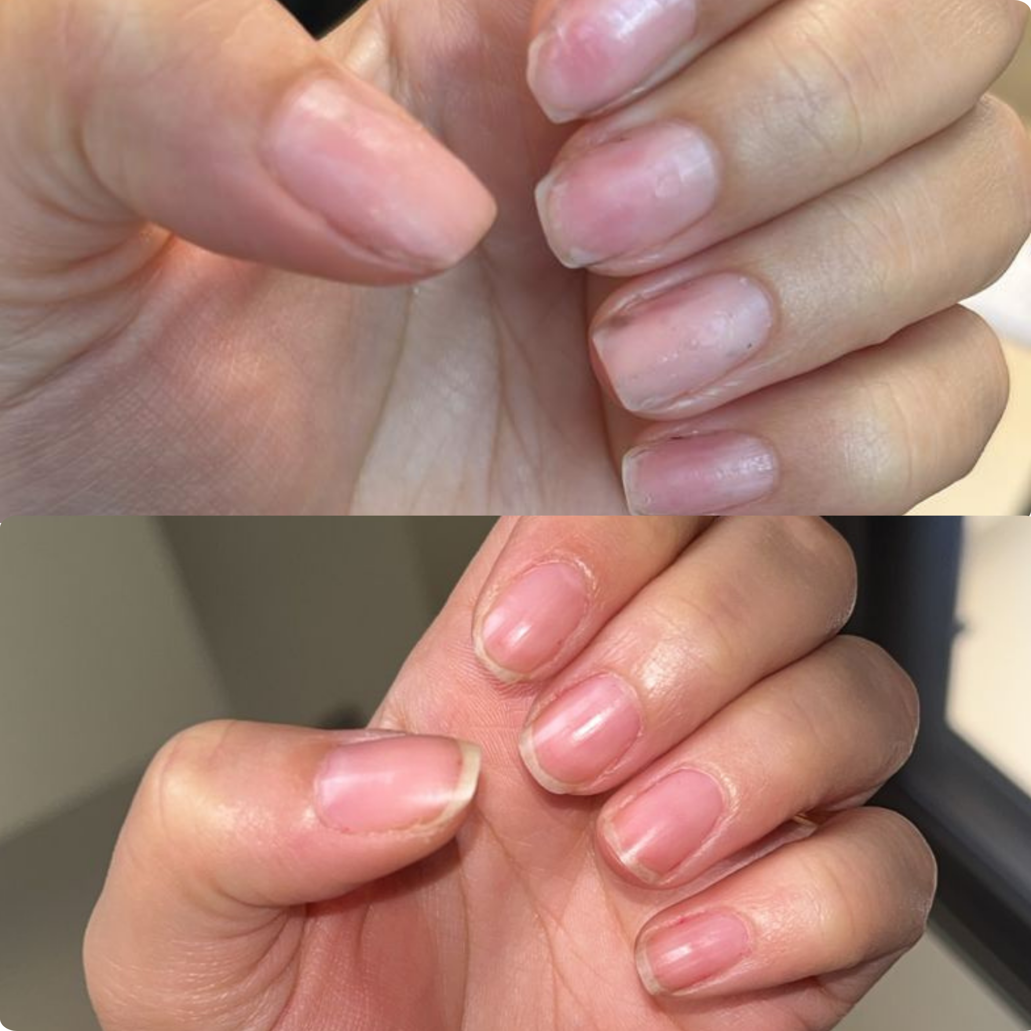A before-and-after comparison of fingernails, showing improvement from dry and damaged to smooth and healthy.
