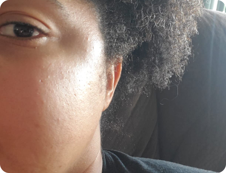 A close-up of the left side of a person's face, showing their eye, cheek, ear, and curly hair.