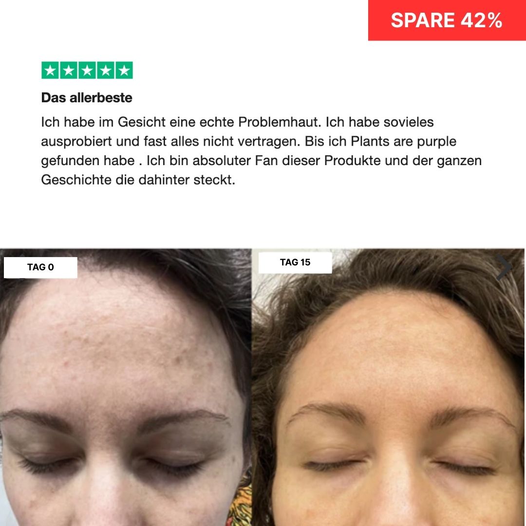 Before and after images of a woman's forehead over 15 days.