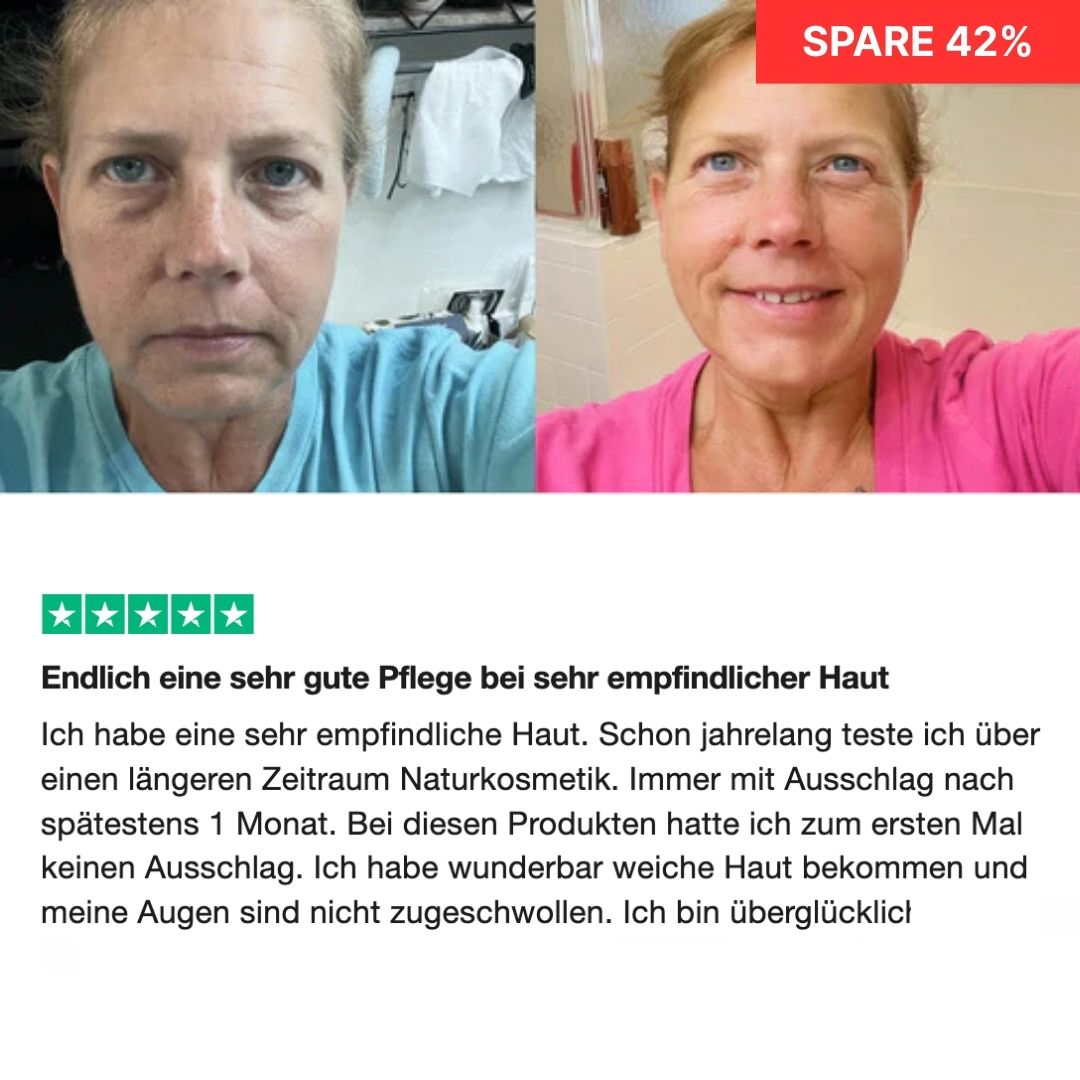 Side-by-side comparison of a woman's face before and after using skincare products.