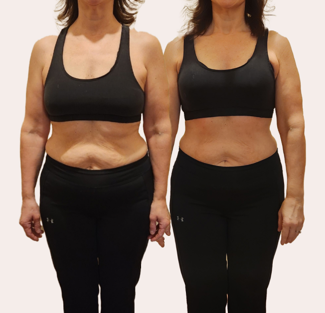 Two images side by side showing a woman in athletic wear.