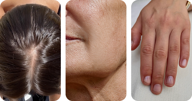 A triptych showing close-ups of a person's hair scalp, facial skin, and manicured hand.