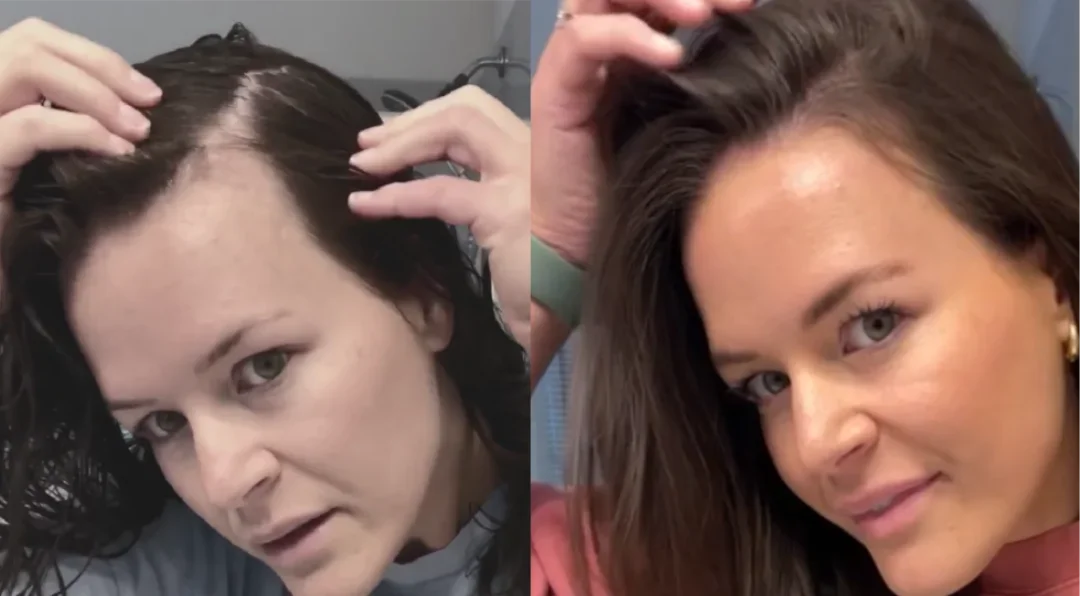 Two images side-by-side, showing a woman parting her hair.
