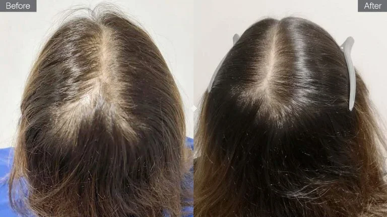 Side-by-side comparison of a person's hair, before and after treatment.