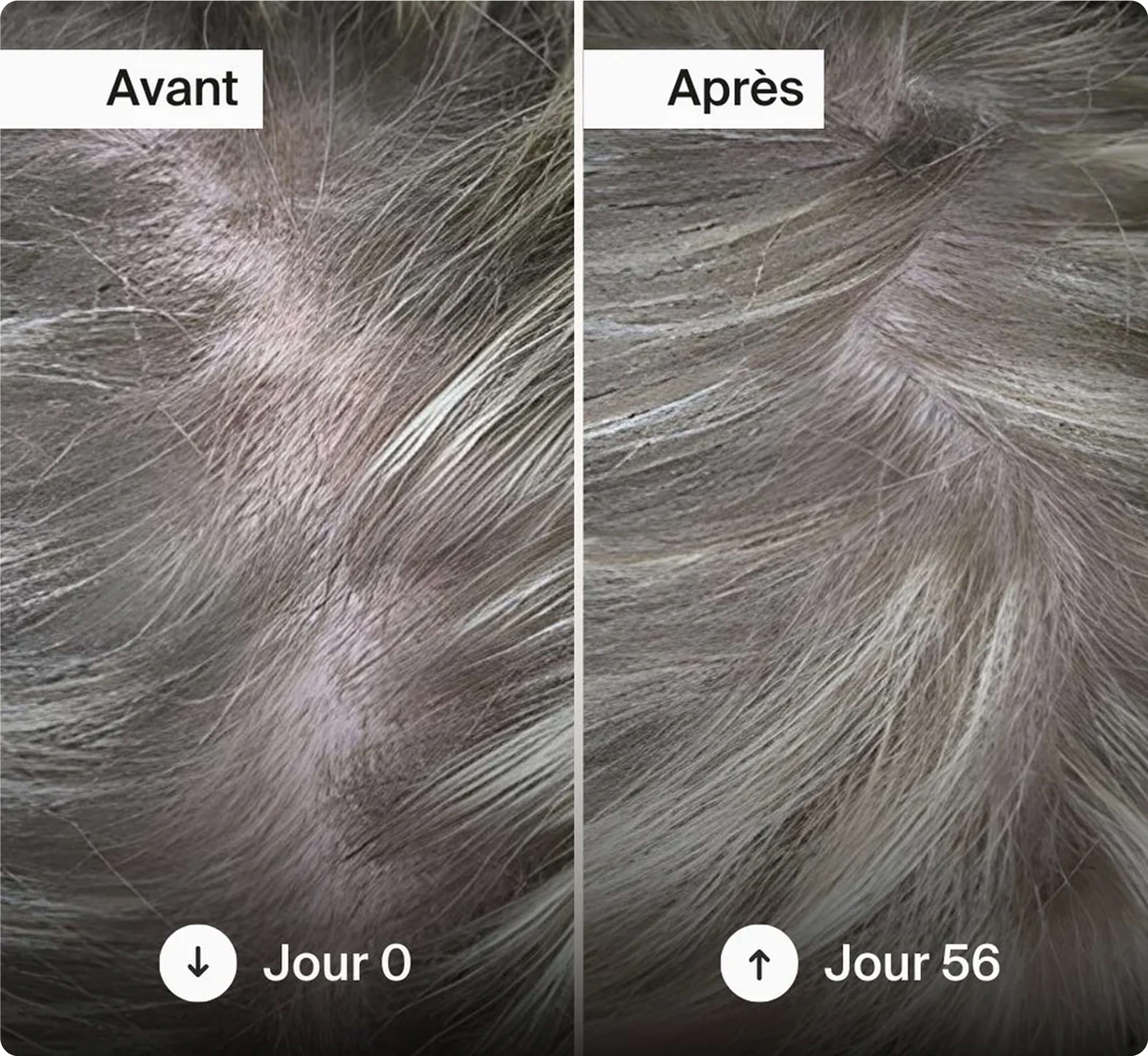 Close-up comparison of hair growth over 56 days.