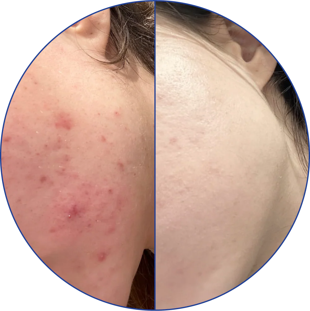 Side-by-side comparison of skin before and after treatment.
