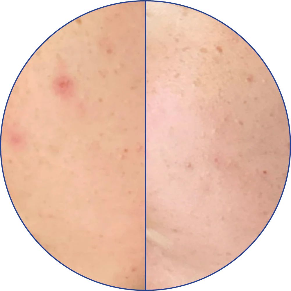 Close-up comparison of skin with spots and smoother skin.