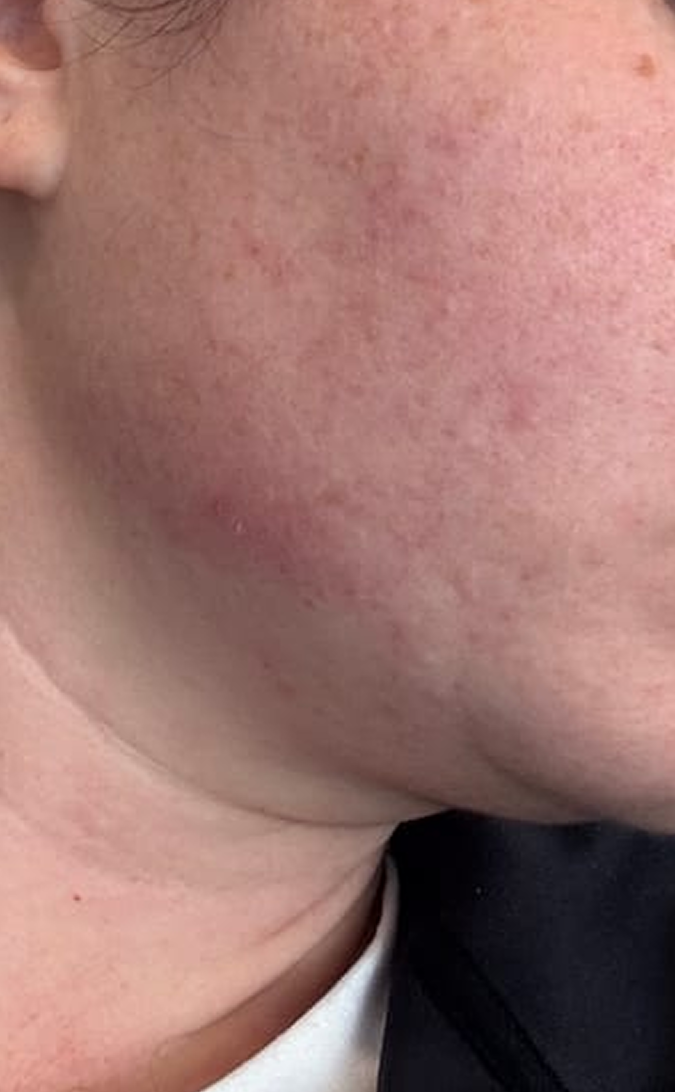 Skin Care After