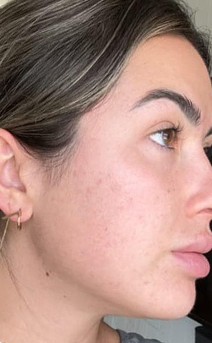 Skin Care After