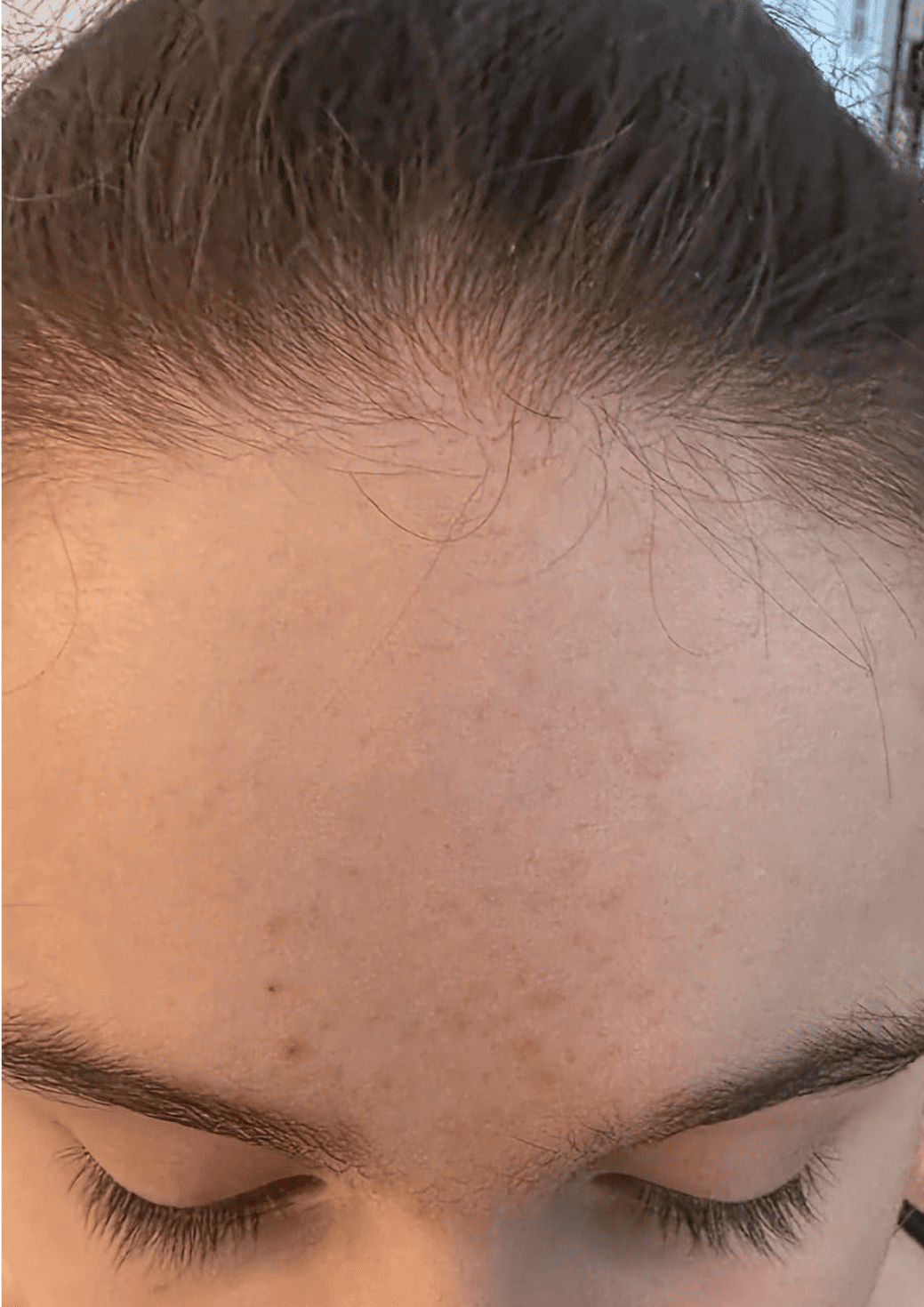 Skin Care After