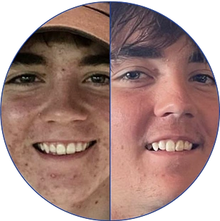 Close-up of two smiling individuals side by side, split by a vertical line.