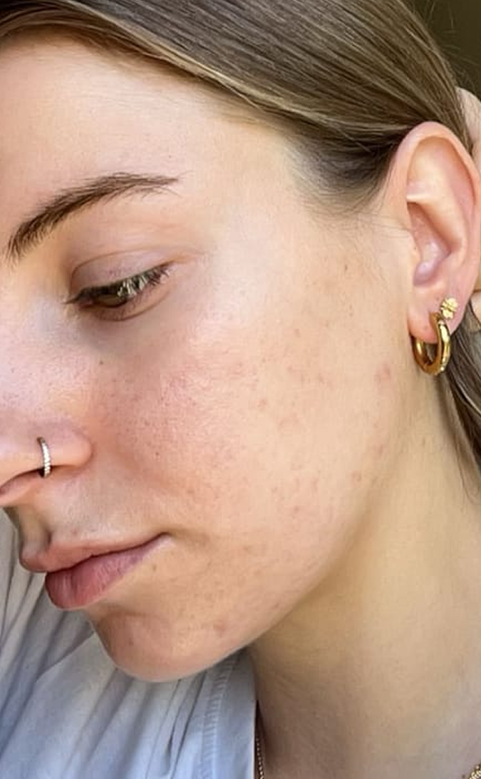 Skin Care After