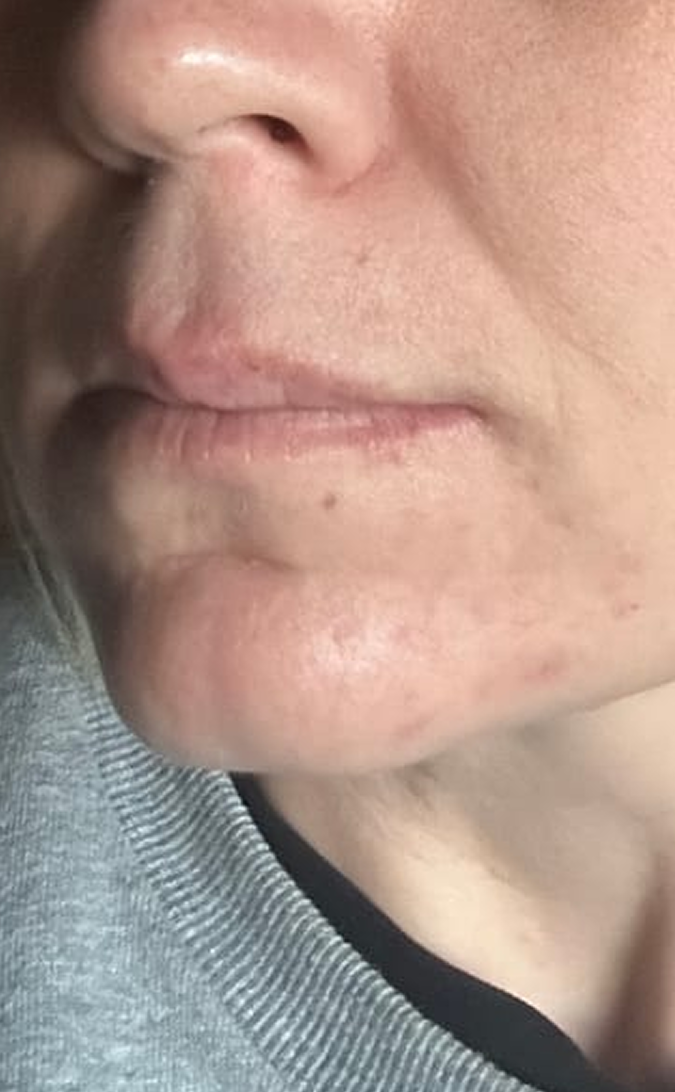 Skin Care After