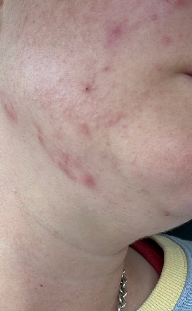Skin Care Before