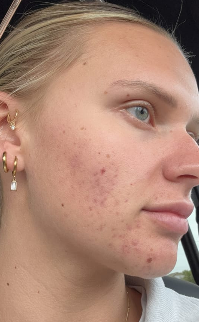 Skin Care After