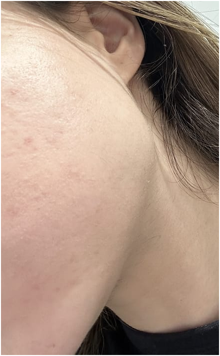 Skin Care After