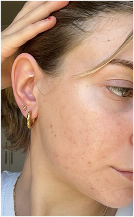 Skin Care After