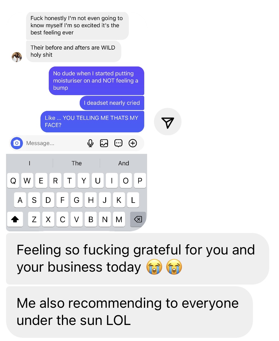 Screenshot of a text conversation expressing excitement and gratitude about skincare results.