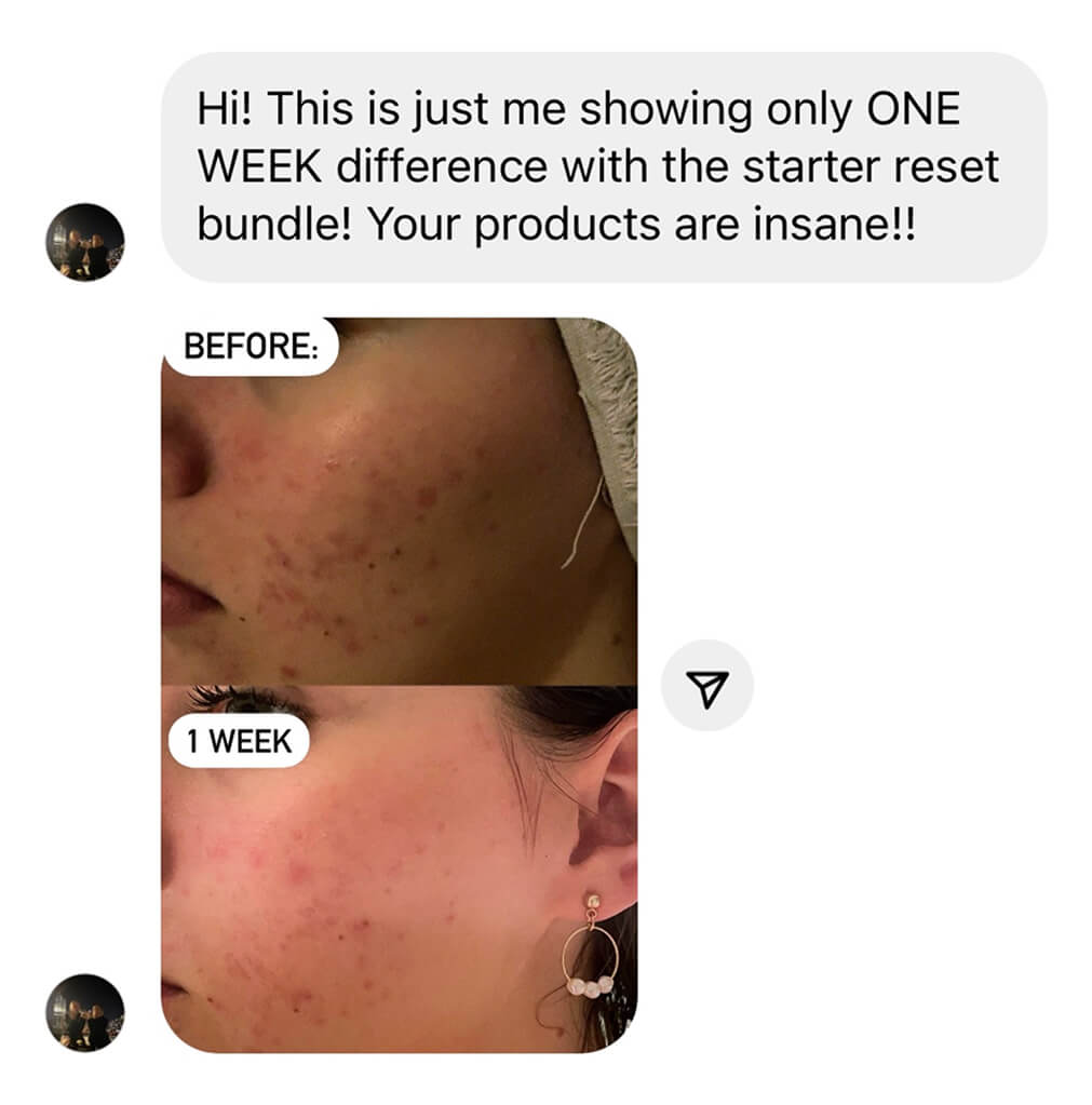 Reviews