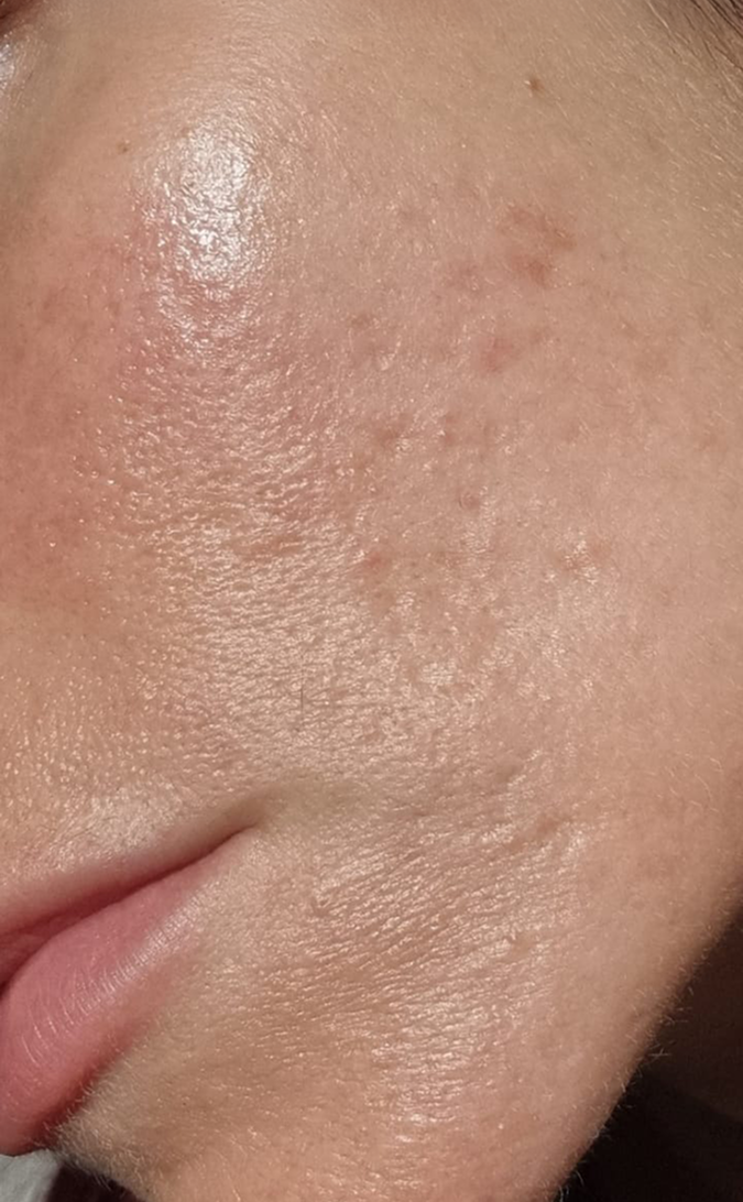 Skin Care After