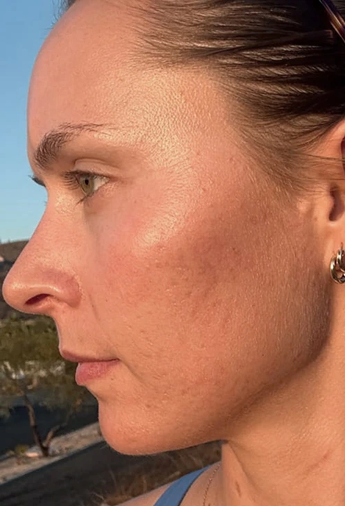 Close-up side profile of a person with earrings and smooth skin.