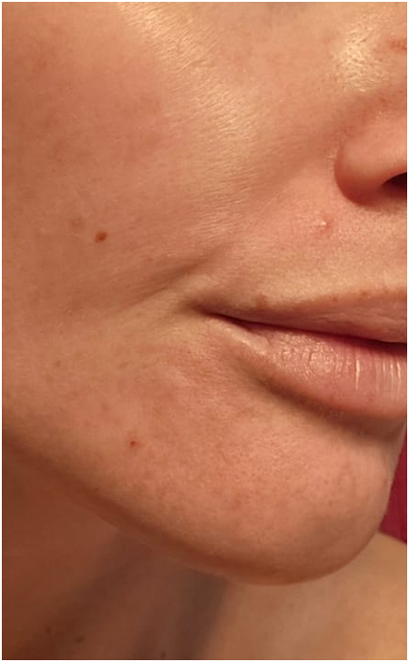 Skin Care After