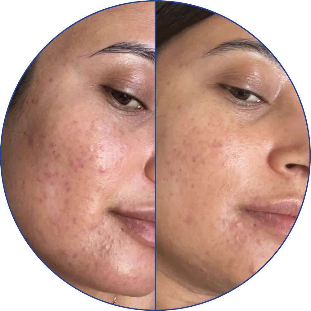 Close-up of a face with skin texture and blemishes visible.