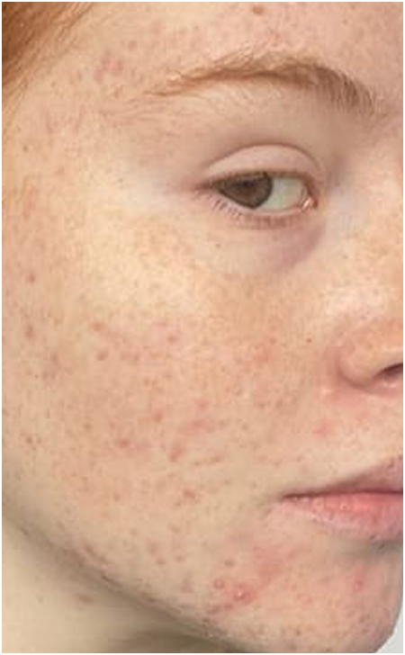 Skin Care After