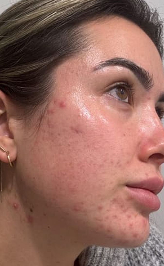 Skin Care Before