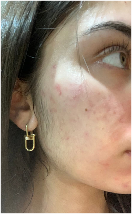 Skin Care After