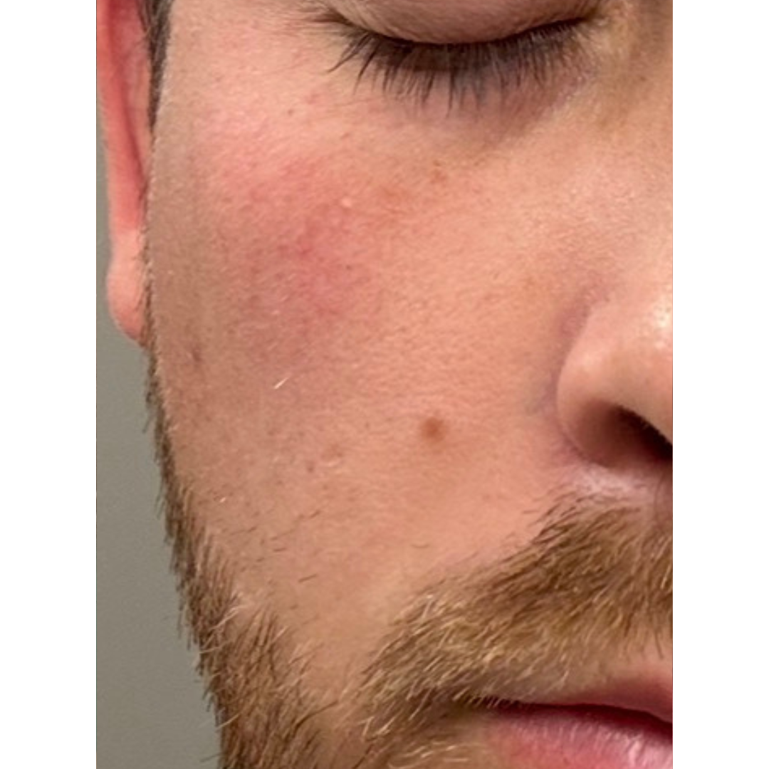 Close-up of a man's face with closed eyes and a beard.