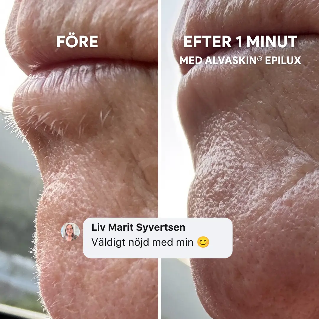 A before and after image showing the removal of facial hair from a person's chin and upper lip.