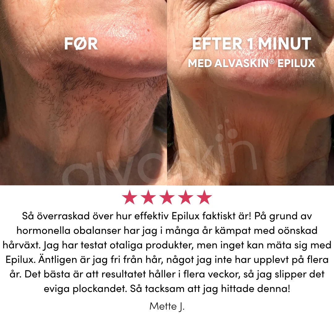 A before and after image showing hair removal on a person's chin and neck area.