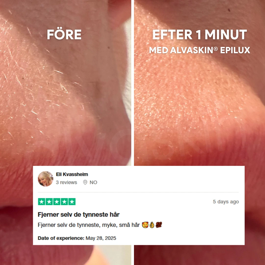 A before-and-after image showing the removal of fine hair from skin, with a customer review below.