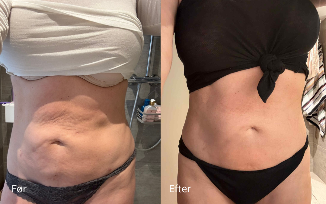Before and after comparison of a midriff in different outfits.