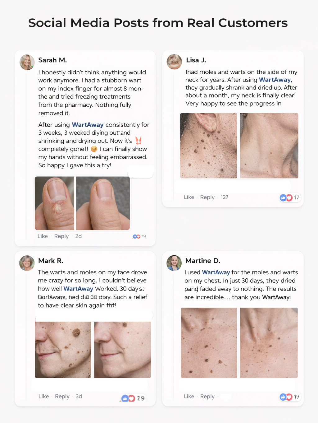 A collage of social media testimonials with before-and-after photos of skin wart and mole removal.